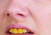 黄牙齿快速变白的方法是什么？有效果的秘诀在哪里？