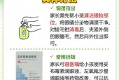 宝宝眼睫毛倒长的原因及处理方法（宝宝眼睫毛倒长的危害）