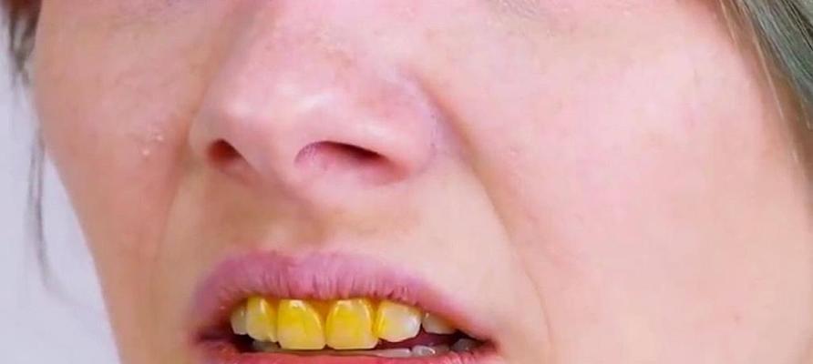 黄牙齿快速变白的方法是什么？有效果的秘诀在哪里？  第1张