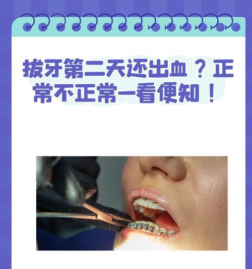 姨妈期间是否可以拔牙（了解这些常识）  第1张