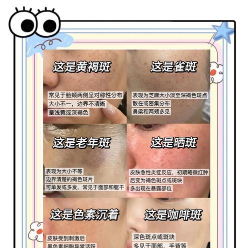 告别面部色斑，重获美白肌肤的秘诀（去除面部色斑及暗沉）  第1张