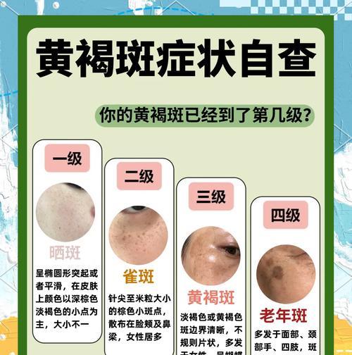 告别面部色斑，重获美白肌肤的秘诀（去除面部色斑及暗沉）  第2张