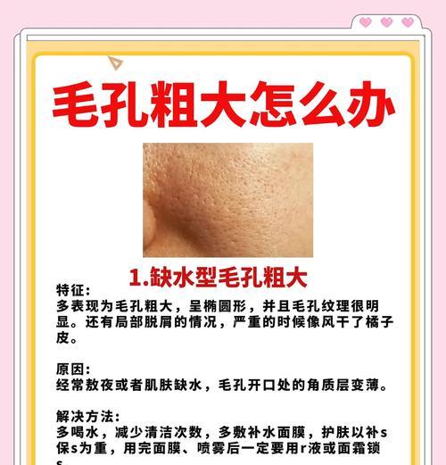 告别毛孔粗大，拥有细腻肌肤（从原因到改善）  第2张