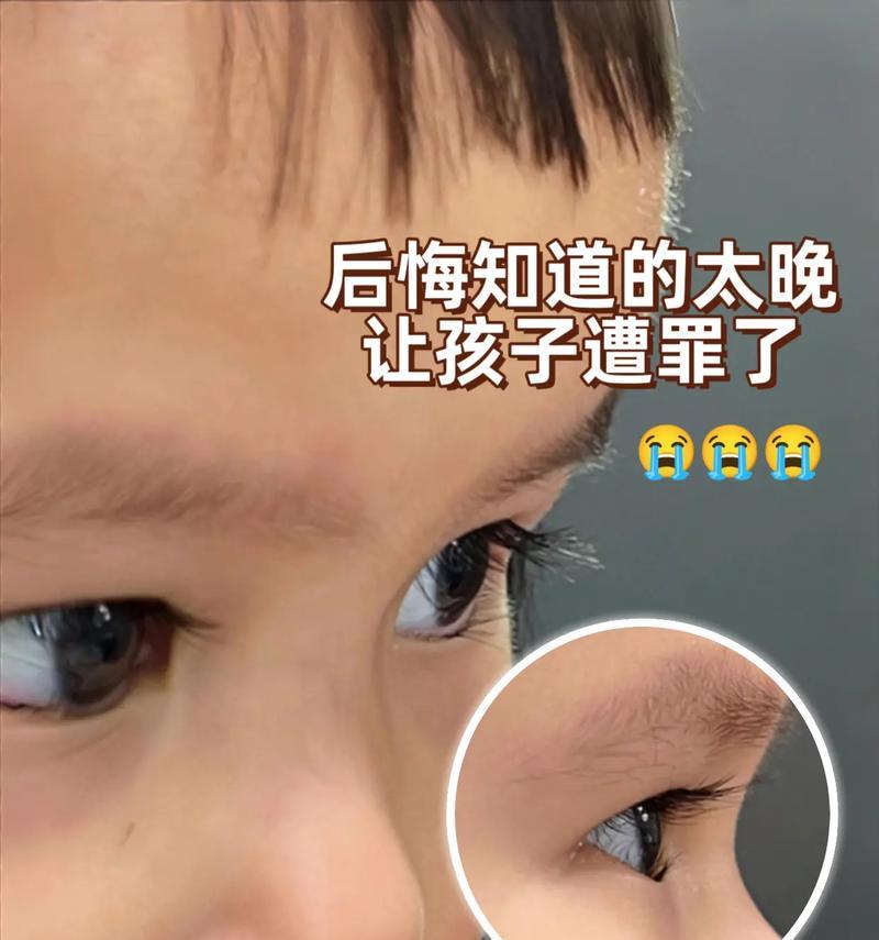 宝宝眼睫毛倒长的原因及处理方法（宝宝眼睫毛倒长的危害）  第2张
