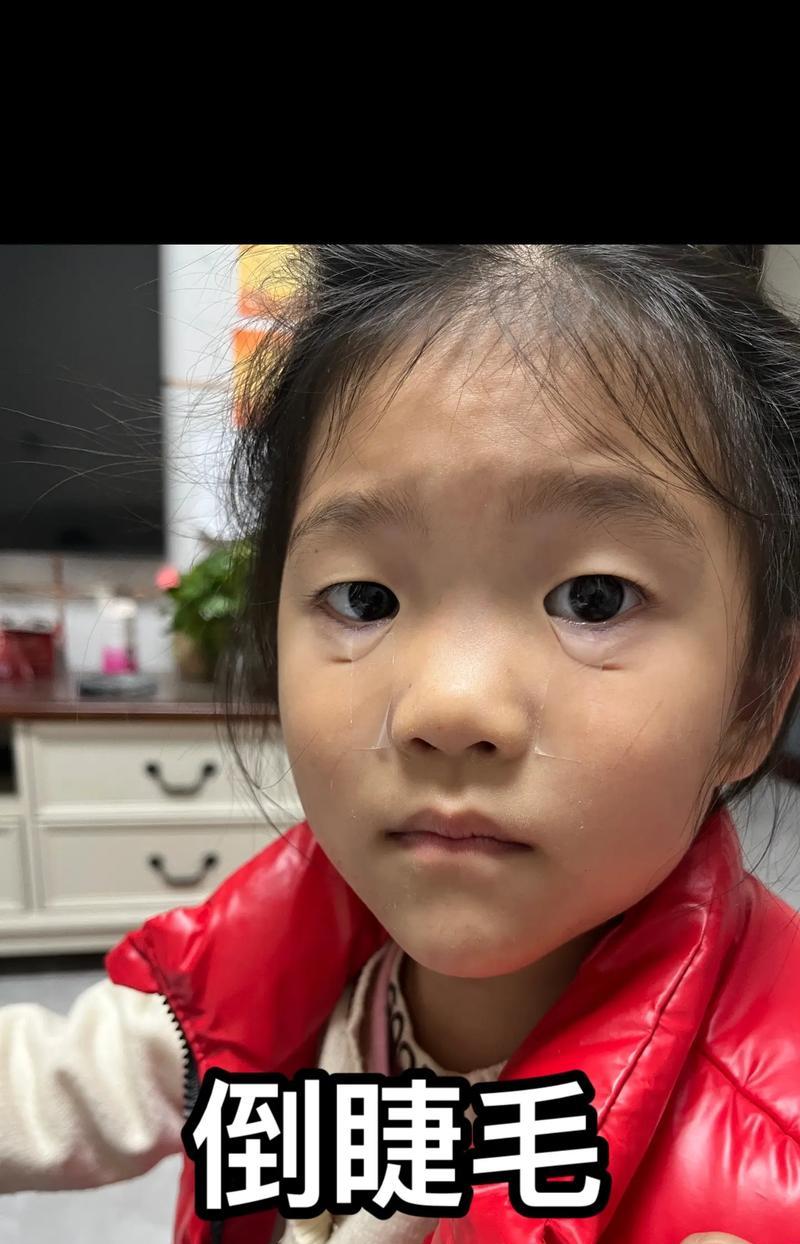 宝宝眼睫毛倒长的原因及处理方法（宝宝眼睫毛倒长的危害）  第3张